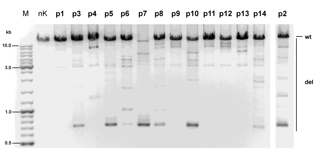 - 45 - Abb. 5: Multiple Deletionen der mitochondrialen DNA im Patientenkollektiv (p1-p14). Das lrpcr- Produkt wurde mittels Agarosegelelektrophorese aufgetrennt.