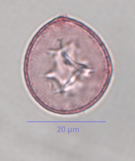 Noch intaktes zweizipfeliges Pollenkorn einer Eibe Links im optischen Schnitt (optical section) : sternförmiges Cytoplasma.