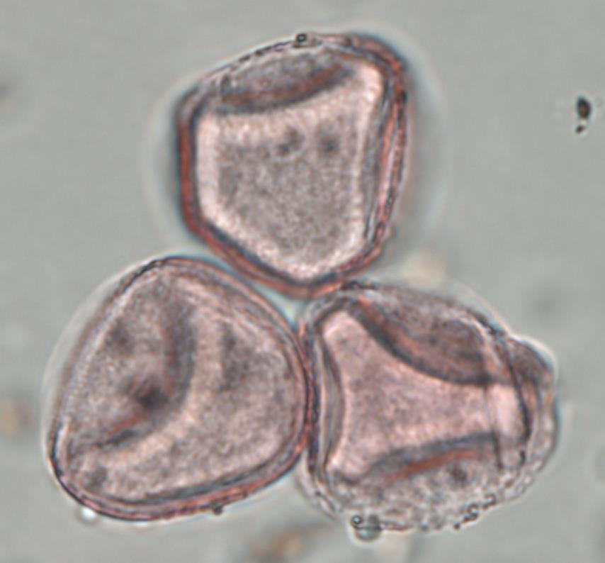 3 Pollenkörner einer Pappel in Oberflächenansicht (surface view).
