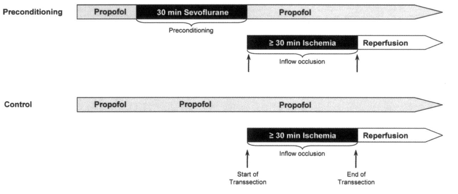Preconditioning: Anästhesie Preconditioning n = 64 N=64 Beck