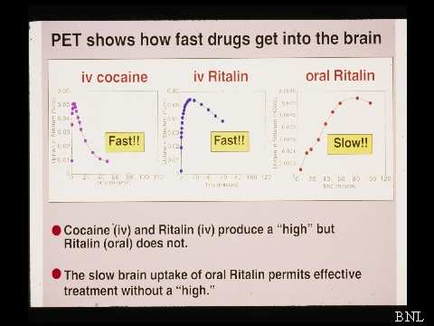 PET zeigt wie schnell Drogen in das Gehirn gelangen.