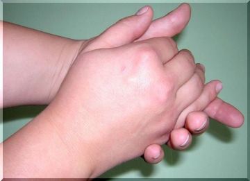 Anlage 1 Hände-Desinfektion Standard Einreibemethode für die