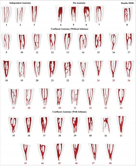 Literaturübersicht Abb. 2: Darstellung der Wurzelkanalkonfiguration von 48 Unterkiefer Molaren (mesiale Wurzel) mittels Mikro-CT. Abbildung entnommen aus: http://rootcanalanatomy.blogspot.