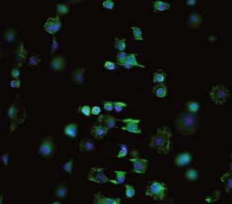 High Low 3 4 Definierte Mikroumgebungen für die 3D-Zellkultur Zellbiologische Untersuchungen erfolgen heute überwiegend auf einer zweidimensionalen harten Oberfläche, wie z. B. einer Petrischale.