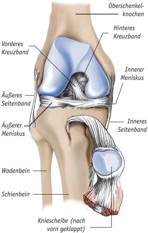 6 z 2 Warum ein künstliches Kniegelenk nötig wird Oberschenkelknochen Vorderes Hinteres Innerer Meniskus Äußeres Seitenband Äußerer Meniskus Inneres Seitenband Wadenbein Schienbein Kniescheibe (nach