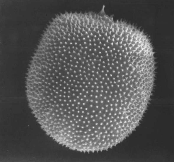 Bodentierentwicklung (Makrozoobenthos) Abbildung 5: Zweigeißelalge (Dinoflagellat) Prorocentrum minimum. Zellgröße 0,02 mm. nungssystem (AlgFES) des LANU dann auch festgestellt wurden.
