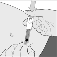 Lassen Sie den Stempel los, und die Nadel wird automatisch aus der Haut in den Sicherheitszylinder zurückgezogen, wo diese dauerhaft fixiert ist (Abbildung F).