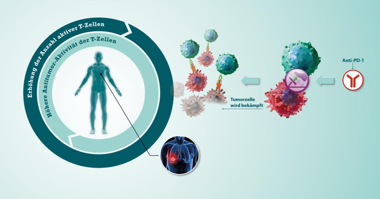 Ansatzpunkte der Immunonkologie spezifische Stärkung der
