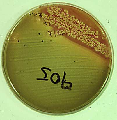 Selektivnährböden mit Hemmstoffen Normalflora wird unterdrückt Selektion der krankmachenden Bakterien