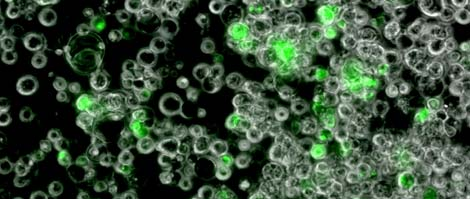 Einbringen von DNA in eukaryotische Zellen: Transfektion Transiente und stabile Transfektion transiente