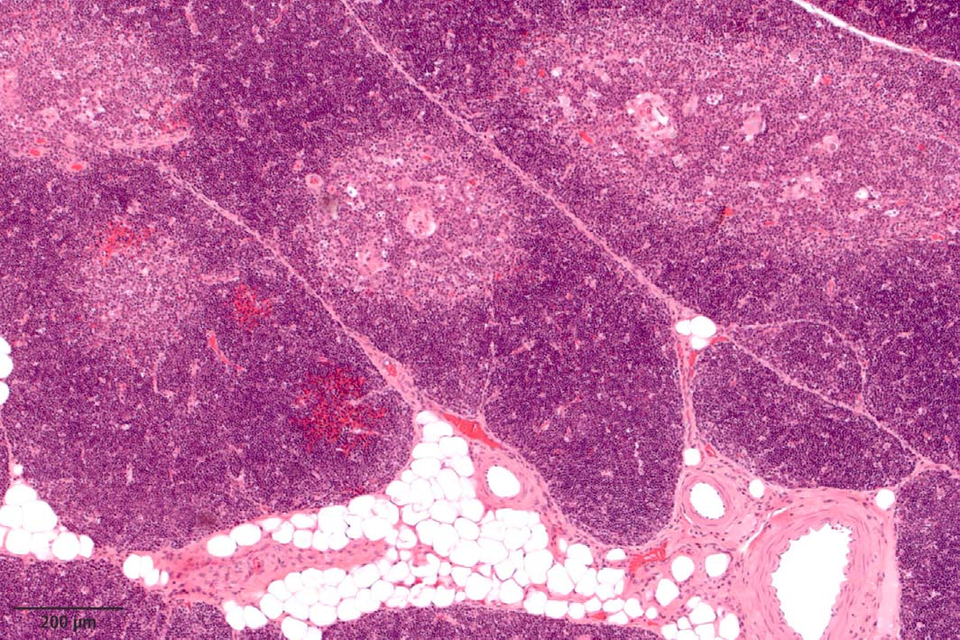 Thymus Histologie mehrere Läppchen jeweils mit Rind (dunkel) und Mark