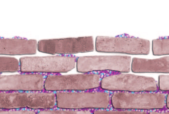 Das Backstein-Zement-Modell Stellt man sich Zellen der Hornschicht als Backsteine vor, so füllen die fettartigen Substanzen als Mörtel den Raum zwischen den Backsteinen aus und bilden so einen