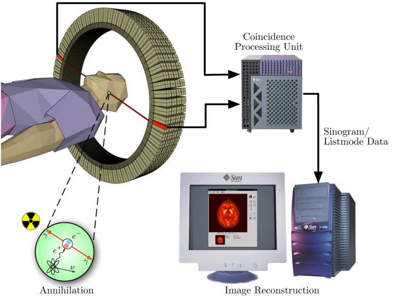 Positron-Emissions-Tomographie (PET) Bildgebenes Verfahren in der Nuklearmedizin Verwendet
