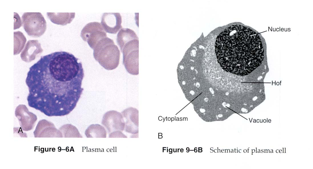 Plasmazelle - Morphologie