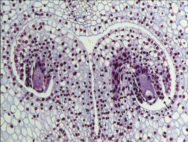 Aufgrund der Lage der Makrosporenmutterzelle lassen sich die Samenanlagen der Angiospermen grob in zwei Gruppen einteilen.