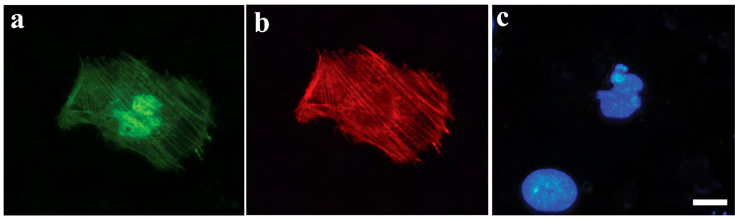 ERGEBNISSE 76 Darüber hinaus wiesen die Par-4/Amida koexprimierenden Zellen morphologische Anzeichen der Apoptose wie kondensiertes Chromatin, fragmentierte Kerne und Membranbläschen (Abb. 17Ac) auf.
