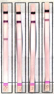 Universität, FJS-Allee, 93053 Evaluation (commercial PCR assay): GenoType
