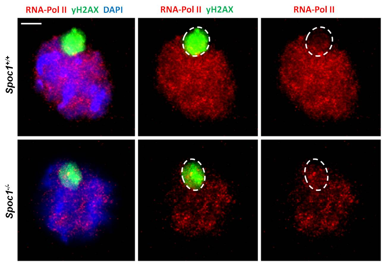 3.5 Untersuchungen zur MSCI Expressionslevel Um die Expression innerhalb des XY-Bodys genauer zu untersuchen, wurden in Meiozytenspreitungen Doppelfärbungen der aktiven Polymerase II (phopho-ser5)