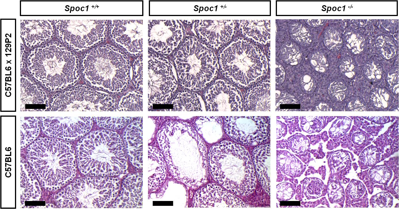 3.2 Untersuchung des Spermatogenesedefekts auf zellulärer Ebene Teil von der Basallamina gelöst. Sie traten in Clustern im Inneren der Tubuli auf.