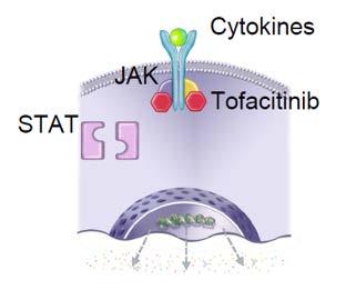 Orales Tofacitinib als Induktionstherapie bei mässiger bis schwerer Colitis ulcerosa: Ergebnisse zweier Phase III Studien Tofacitinib ist ein Molekül, dass die Janus-Kinase 3 hemmt, die in die