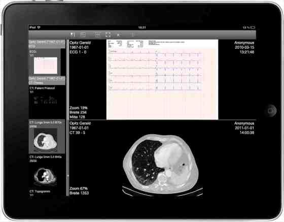 JiveX Mobile EKG Untersuchung