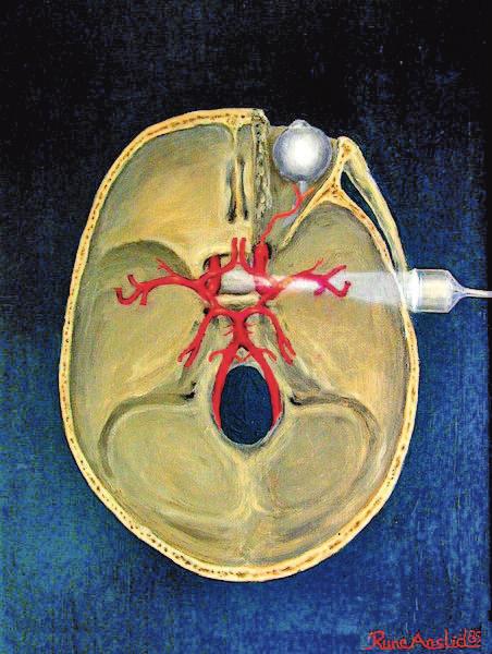 14 Aus den Verbänden Die Wissenschaftlichen Arbeitskreise Kardioanästhesie und Neuroanästhesie der DGAI, die Cardiovascular and Thoracic Anaesthesia Group der SGAR sowie die DGTHG empfehlen die