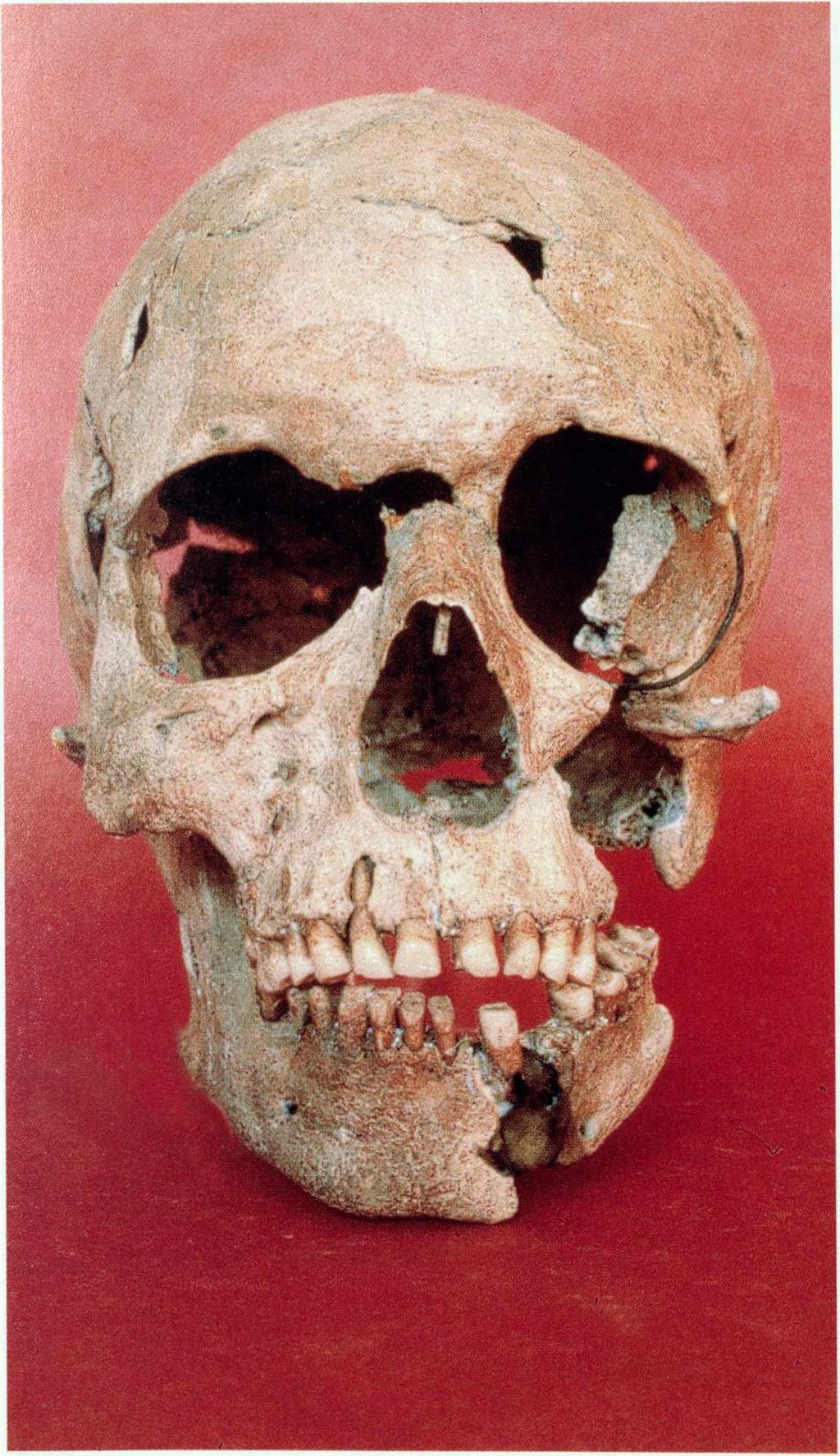 am besten erhaltenen Schädel bearbeitet, wobei es nur vier Skelette gab, die einen vollständigen Kopf mit Unterkiefer aufwiesen.