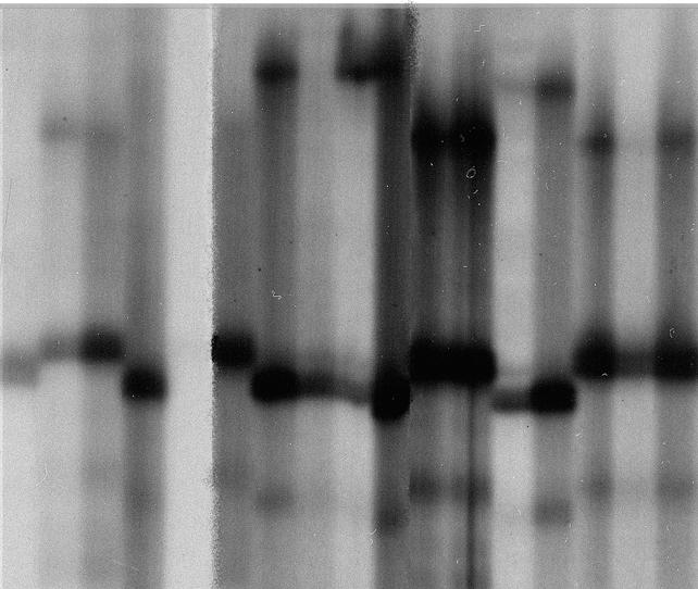 Ergebnisse 46 3.1.1.2 SSCP-Analyse mit radioaktiven Isotopen Die SSCP-Analyse wurde ebenfalls mit radioaktiv-markierten PCR-Produkten durchgeführt (Abschnitt 2.4.2.3). In Abbildung 3.