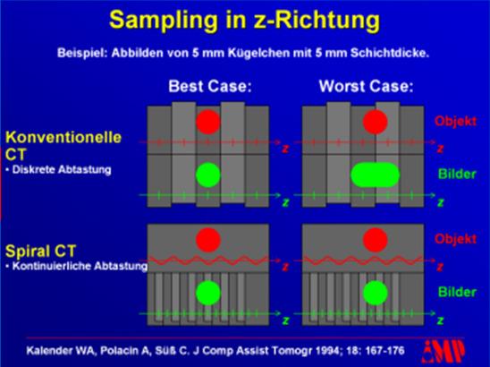 MSCT Grundlagen und Besonderheiten Technik Scan Grundlegende Parameter Detektorkonzepte Algorithmen Gefilterte