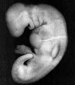 Bild 6: Wenn man das Äußere eines Embryos in der mudghah Phase mit einem Stück Kaugummi vergleicht, findet man Ähnlichkeiten zwischen den beiden.