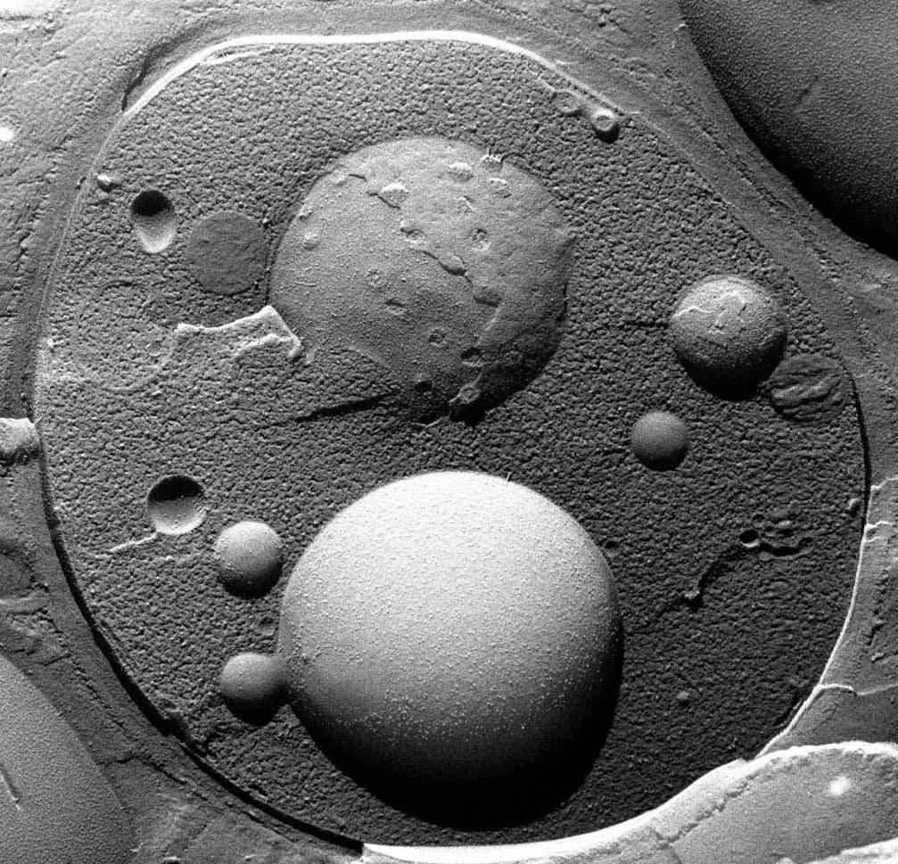 12 Hefezelle im Rasterelektronen-Mikroskop - (Gefrierbruchtechnik) Quelle Bild: EM-Aufnahmen mit