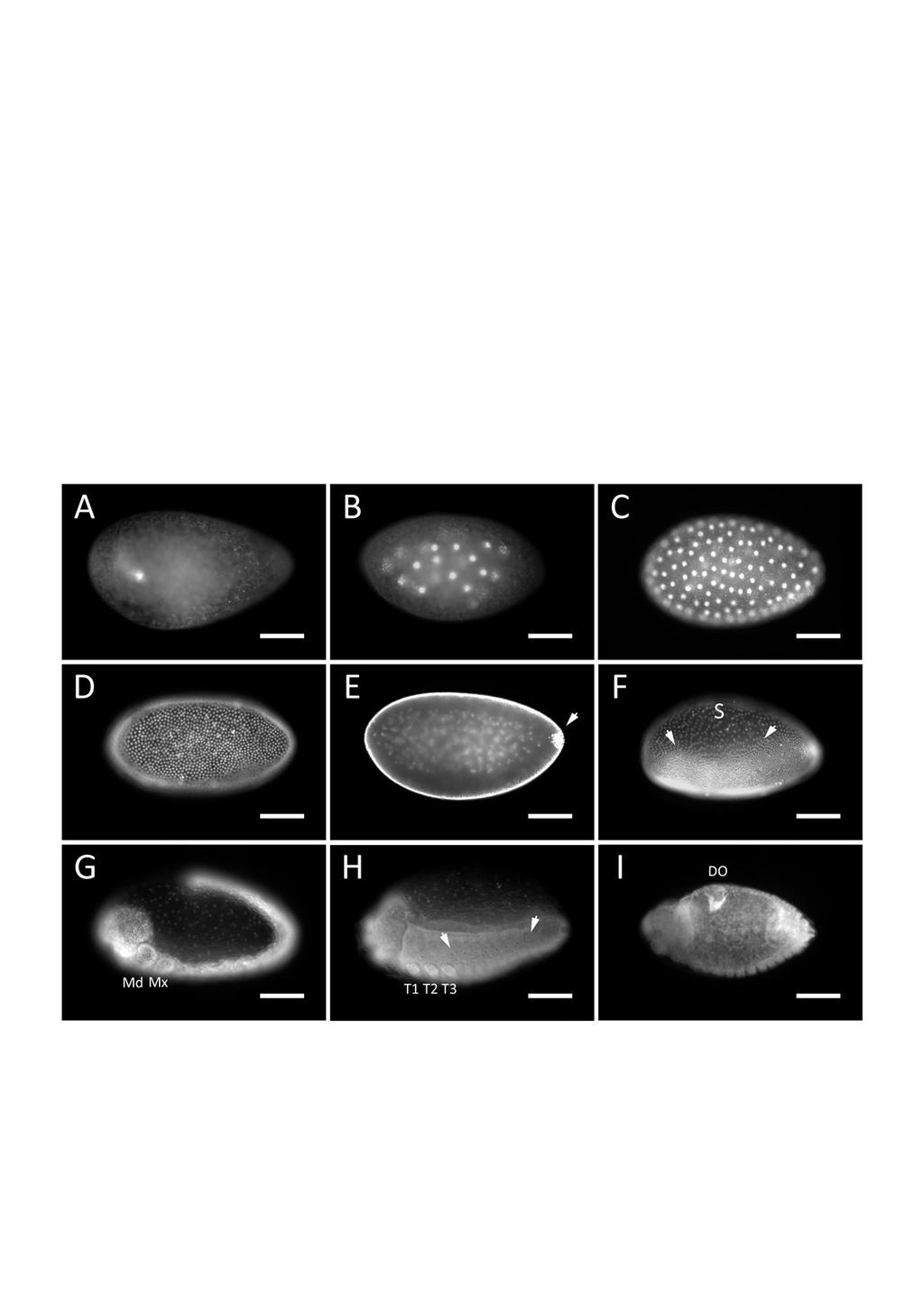 I. Kapitel: Bruchidius hunchback - Ergebnisse es bleiben weniger Zellen, dort entwickelt sich die Serosa, eine extraembryonale Membran (Abb. 6: F).