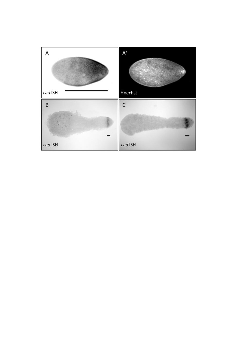 II. Kapitel: Mex-3/Cad System - Ergebnisse (Abb. 15: A). Im Zuge der Keimstreifbildung wird die caudal-expression auf einen schmalen Streifen am posterioren Ende des Embryos begrenzt (Abb.