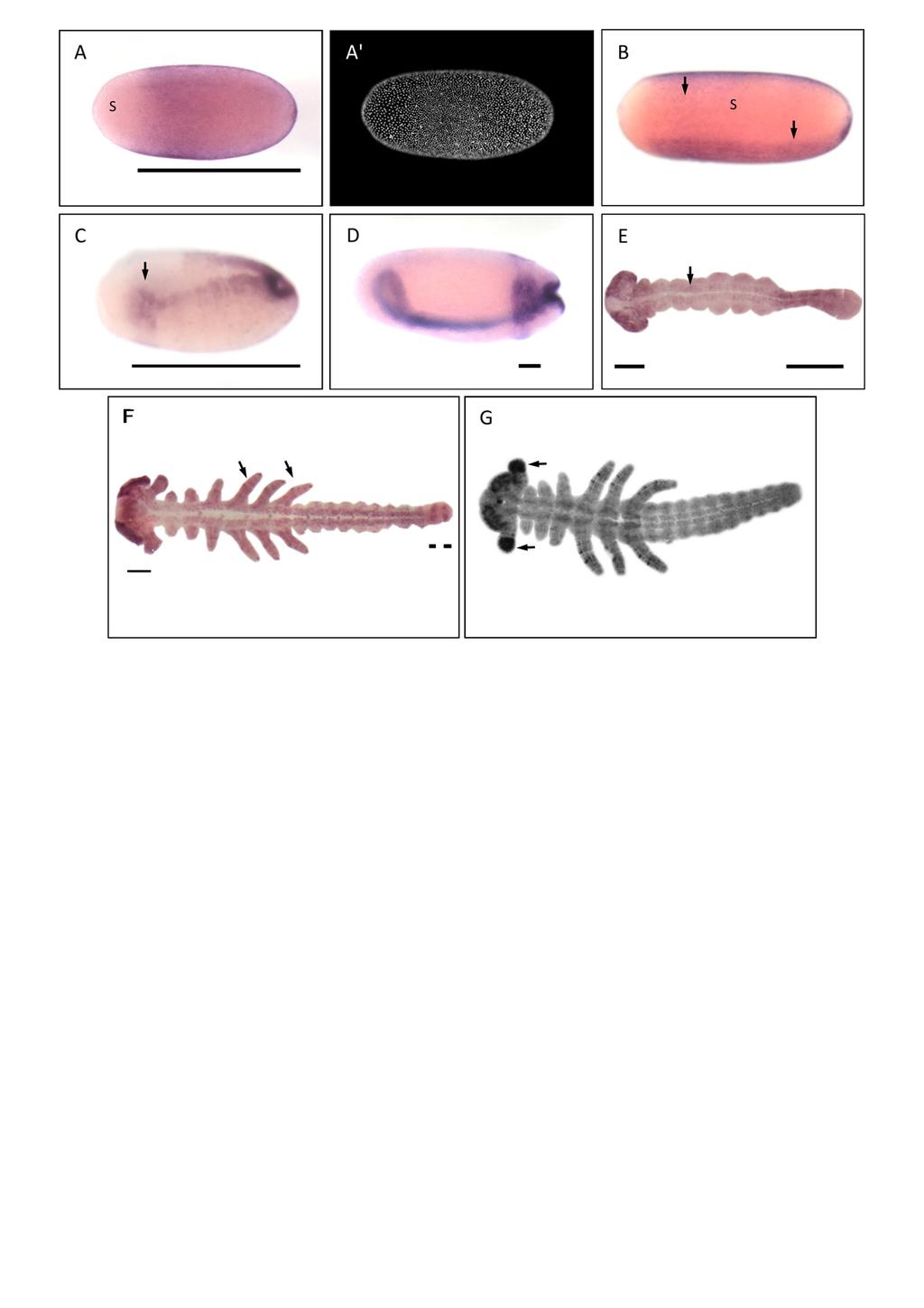 II. Kapitel: Mex-3/Cad System - Ergebnisse Abb. 24: Die Expression von mex-3 in der Oncopeltus-Embryogenese A) Im späten Blastoderm ist eine breite Expression von mex-3 erkennbar.