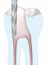 Der Kurs: Endo Kompakt legt den Fokus dabei auf den gesamten endodontischen Behandlungsablauf.