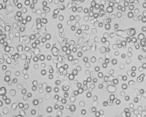 Um die morphologischen Veränderungen in FADD/DD-induzierten B16-Zellen deutlich zu machen, wurden die Zellen unter dem
