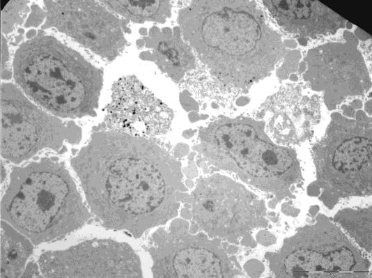 In Abbildung 15 ist die Kernmorphologie von FADD/DD-induzierten B16-Zellen abgebildet.