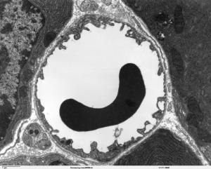 Hb-NO CD40L Microparticles Changes in RBC during