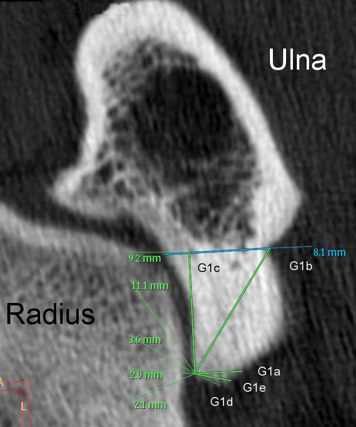 Ulna mit eingezeichneten Messlinien ausgehend von der axialen Kortikalis am kranialen Ende der radioulnaren Gelenkfläche.