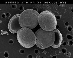 mit intrazellulären CaCO 3 Kristallen Phacotus lenticularis, eine Grünalge mit einer