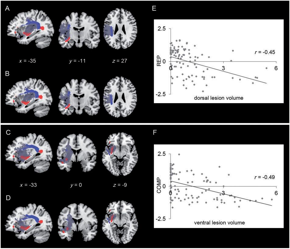 Lesion mapping in acute aphasia Brain 2013: 136; 619 629 625 Figure 4 Overlap of the dorsal (in blue) and the ventral (in red) long-distant association tracts from Saur et al.