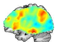 Note the dorsoventral gradient in the temporal lobe