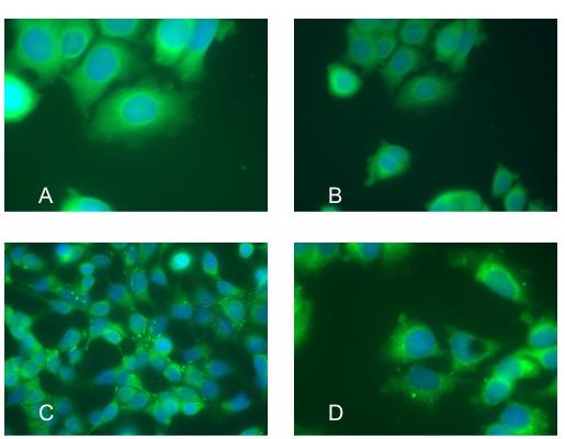 Abb. 5 Austesten der MMP-Antikörper an der Mamma-Carcinom-Zelllinie