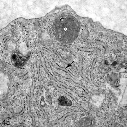 Abb. 4a: TEM Aufnahme einer beschallten Endothelzelle (Zellausschnitt). Raues endoplasmatisches Retikulum (Pfeil), Lysosom mit Abbauprodukten (Stern). Originalvergrößerung 12.000 x.