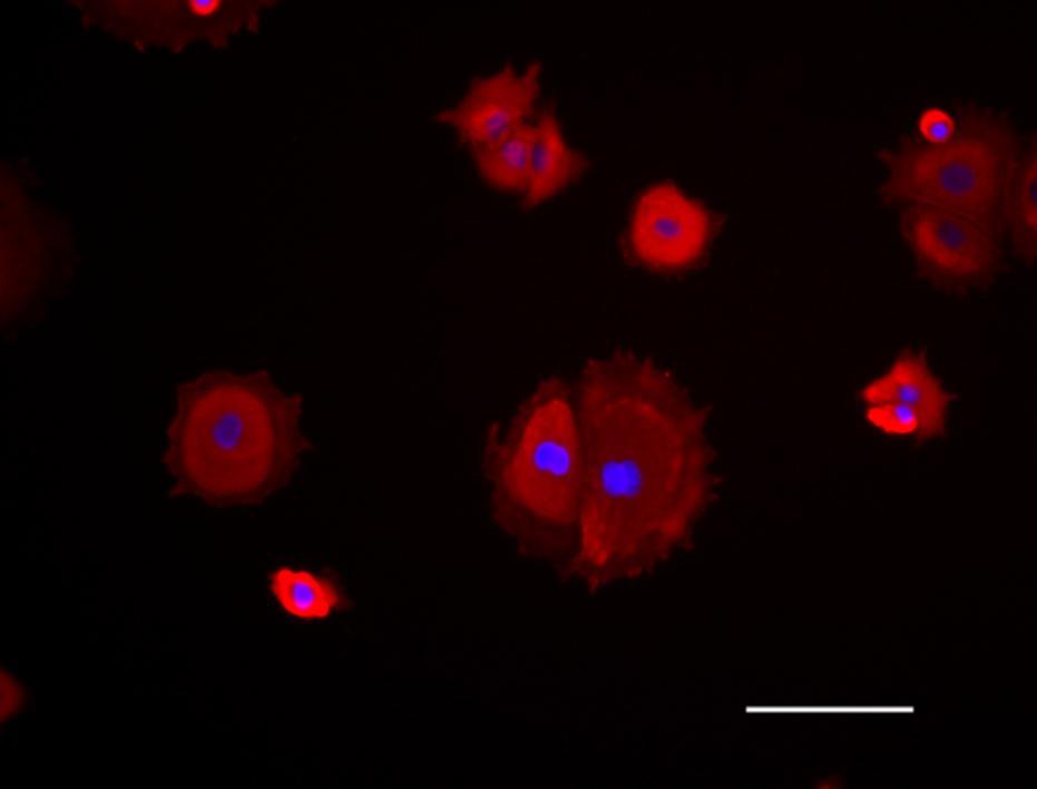 Ergebnisse Mikroskopisch konnten die Zellen anhand ihrer charakteristischen kopfsteinpflasterartigen Morphologie ( cobblestone ) als Keratinozyten identifiziert werden.