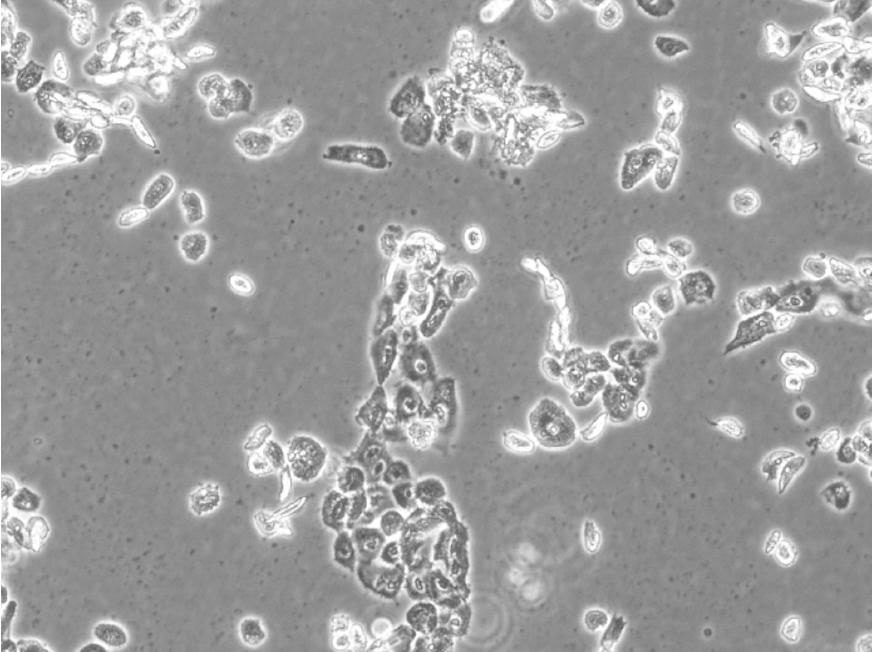 Zellzwischenräume und tote Zellen mit Karyopyknose sichtbar, beginnende Zusammenhangstrennung