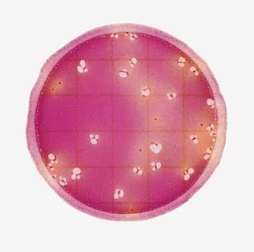 3. 4. Enterobacteriaceae-Auszählung = 0 Zu beachten ist die Farbänderung in den Abbildungen 3-8. Mit Zunahme von Enterobacteriaceae verfärbt sich das Gel von violett bis hin zu gelb oder cremefarben.