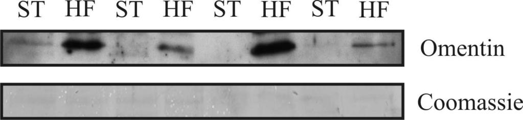 3 Ergebnisse 117 Abbildung 48: Detektion von Omentin mittels Immunoblot in den gepaarten Proben subkutanen und viszeralen Fettgewebes von vier C57BL/6 Mäusen.