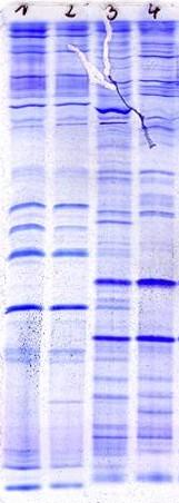 Nachweismethode Proteinchemischer Tierartennachweis mittels isoelektrischer Fokusierung. γ 2 -Casein Kuh γ 3 -Casein Kuh 1.