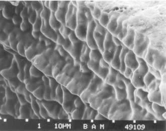 Die Bruchtopographie im REM zeigt die charakteristische Struktur aus eingeformten Dendritenspitzen (Bild 4).